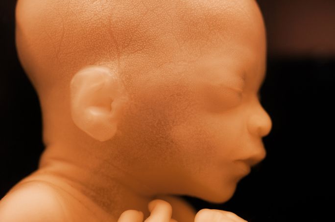 Abortion: New York Law Sparks More Controversy