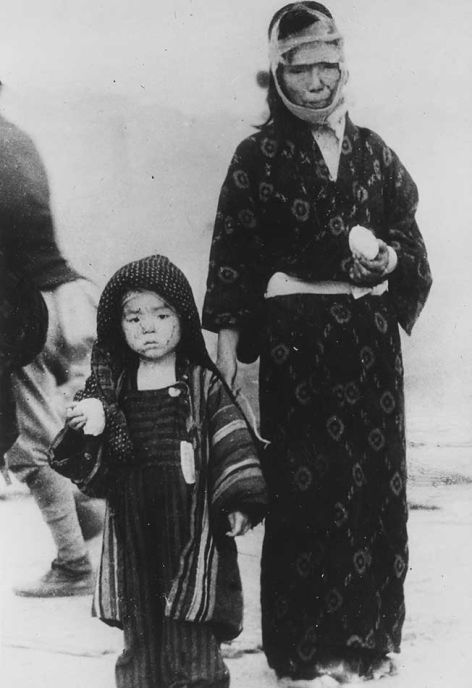 <p>A mother and son receive emergency relief 1 mile from ground zero, Nagasaki.</p>