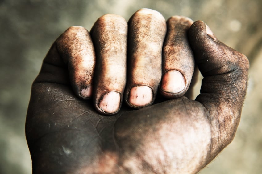 Fighting the Works of the Flesh: Uncleanness