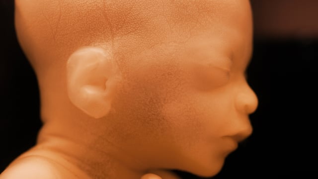 Abortion: New York Law Sparks More Controversy